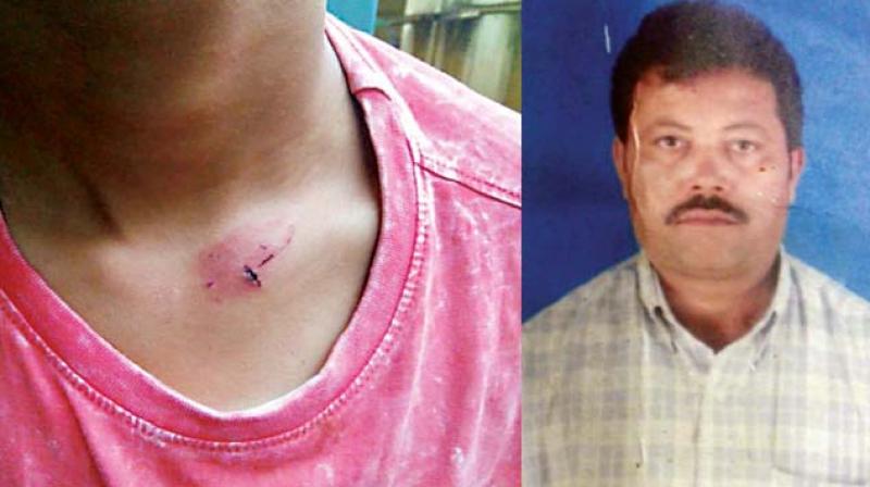(Left) Visual of the injury sustained by the child in the neck region. (Right) The absconding father, Sayyed Sageer