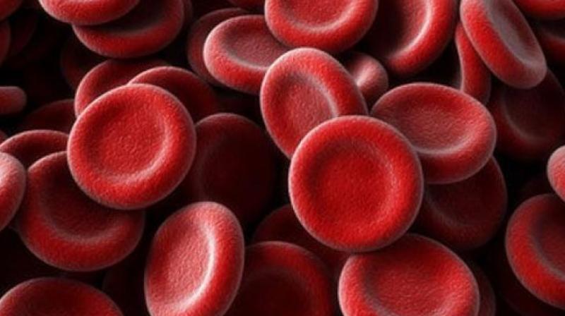 Around 50% of the world sickle cell population resides in India and highest prevalence is noted in Gujarat, MP, Maharashtra, Chhattisgarh, Odisha, TN, Kerala and Karnataka.  (Representational image)