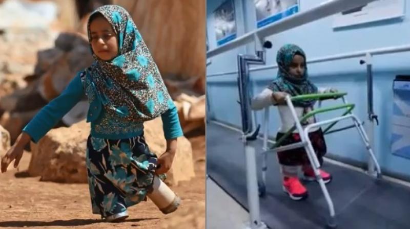 A specialist gave her a life changing procedure for free and while she can walk, it may take months for her to have full mobility (Photo: YouTube)