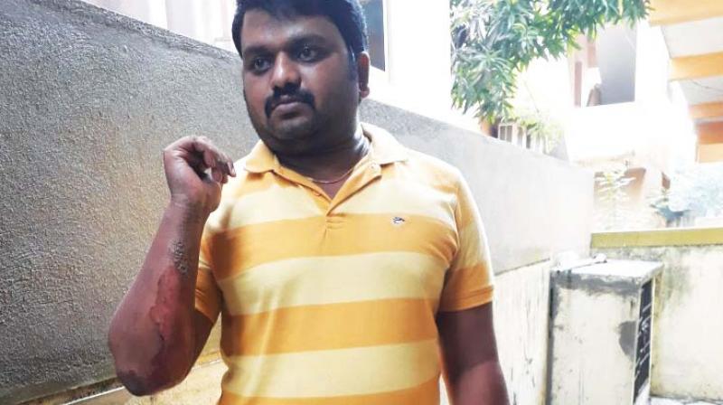 Ramkumar shows injuries he suffered while trying to help the victims (Photo: DC)