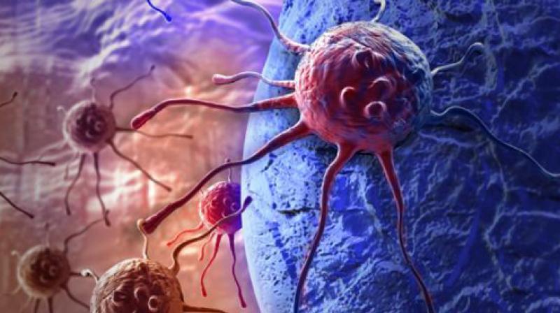 Immunotherapy drugs are found to have a better treatment response than chemotherapy and the survival rate is also better.(Picture Courtesy: File photo)