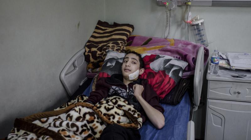 Abdul-Hameed, 15, lies in a hospital bed at West Emergency Hospital in Irbil, Iraq. Abdul-Hameed was injured in an Islamic State militant mortar attack in Mosul. (Photo: AP)