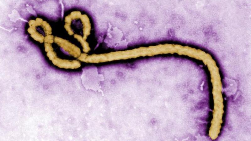 New Ebola virus found in Sierra Leone. (Photo: AP)