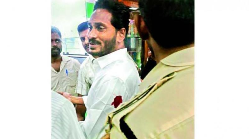 YSRC president Y.S. Jagan Mohan Reddy being treated at a hospital on Thursday.