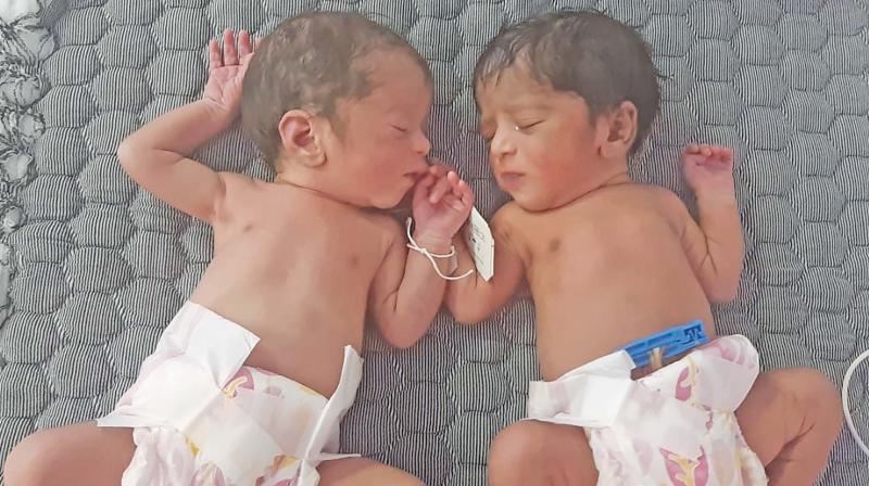 Female triplets born at Coimbatore Medical College and Hospital (CMCH) on Friday. (Image DC)