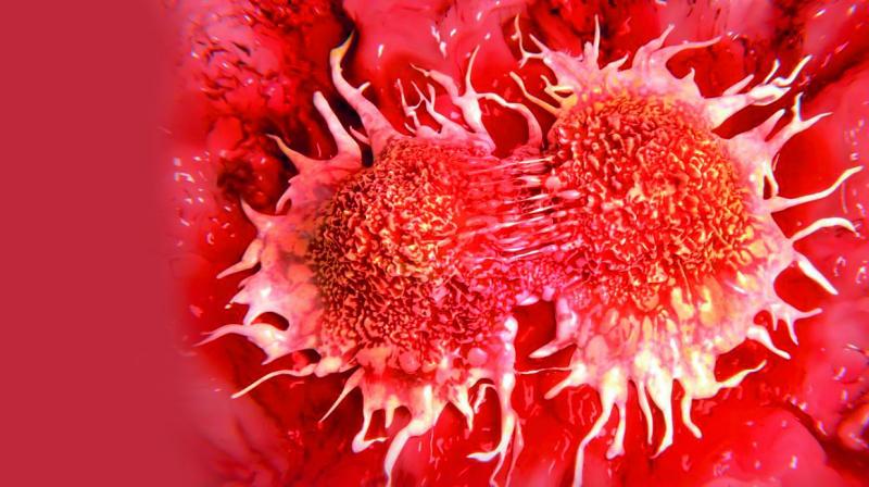 During metastasis, cancer cells break away from the tumour in the primary site and travel to other parts of the body through the bloodstream or the lymphatic system.