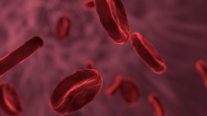 Facts about sickle cell disease. (Photo: Pixabay)
