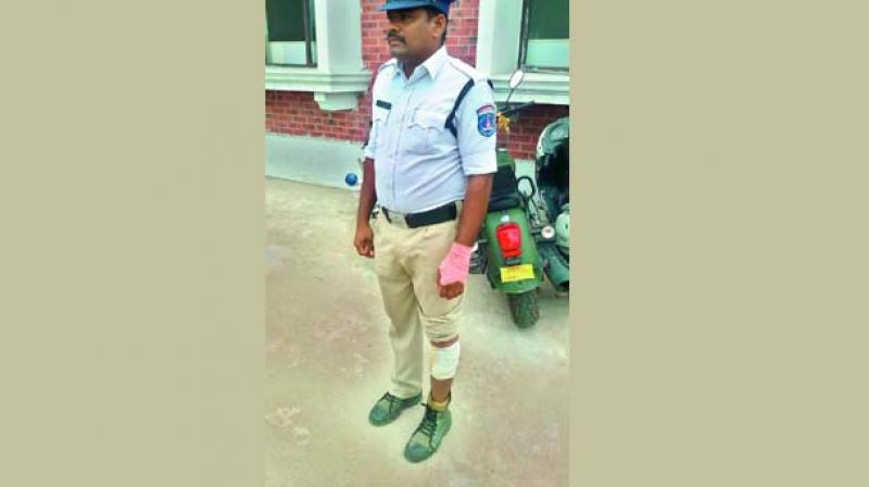 Constable Narender who was injured while trying to stop bike racers.
