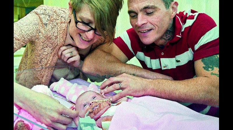 Naomi Findlay and Dean Wilkins look at their daughter, three-week-old Vanellope Hope Wilkins at Glenfield Hospital in Leicester. (Photo: AP)