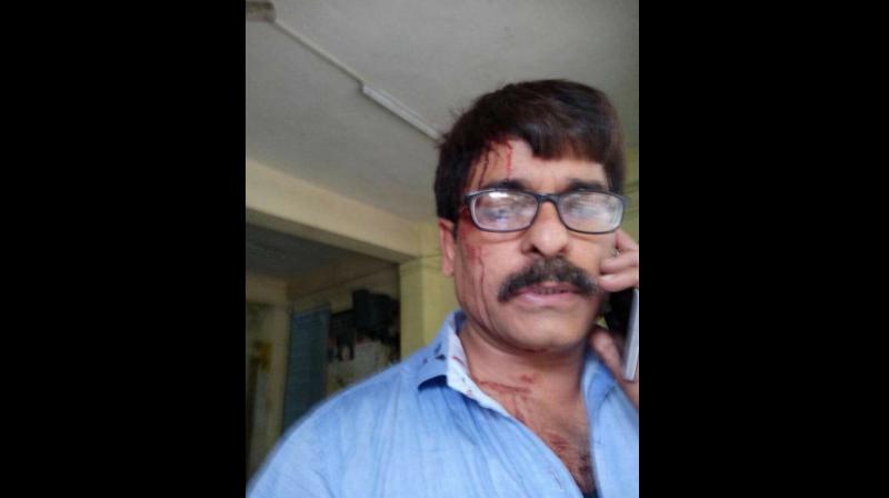Sudhir Shukla, who works for a Hindi news channel, sustained injuries in the attack that took place between Mira Road and Andheri railway stations. (Photo; Facebook)