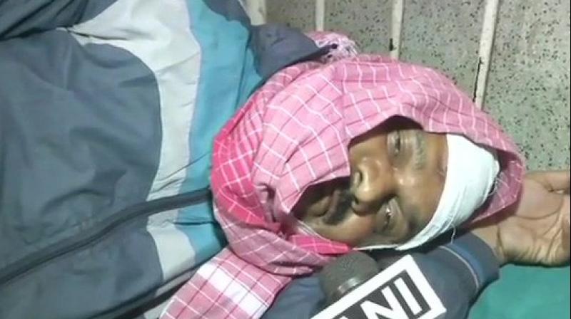 After the arrest, Manoj Baitha was shifted to Patna Medical College & Hospital from Sri Krishna Medical College & Hospital for treatment of the injuries he suffered during the accident. (Photo: ANI)