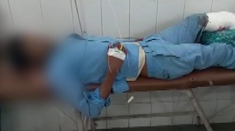 Doctors use patients severed leg as pillow in UPs Jhansi, probe ordered