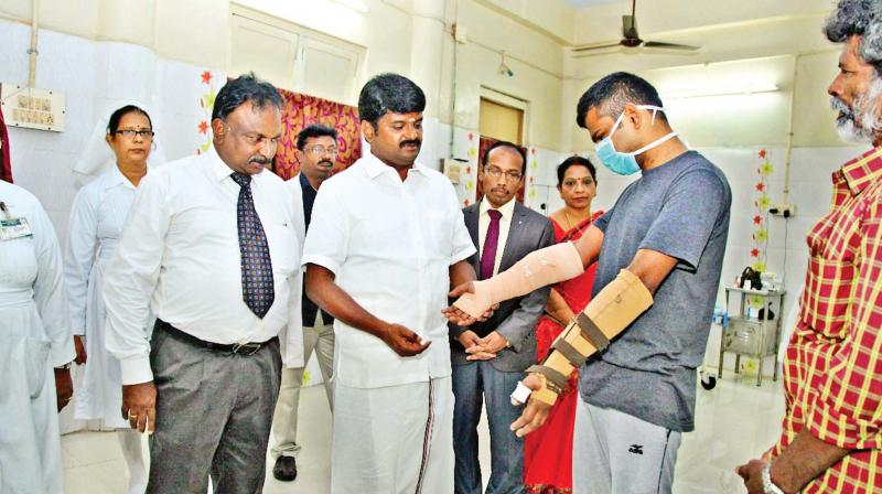 Health minister C. Vijayabaskar talks to hand transplant survivor at Stanley Medical College and Hospital on Tuesday. (Photo: DC)