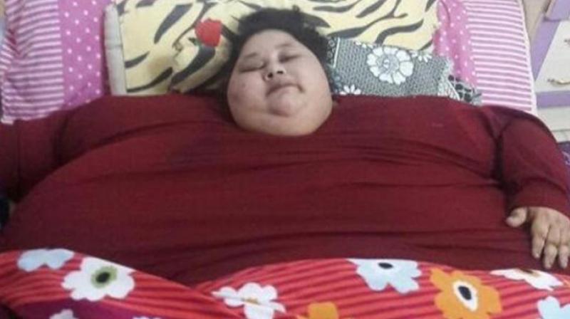 Eman Ahmed who weighs 500 kilograms hadnt moved from her bed for the past 25 years before she came to Mumbai for the operation. (Photo: AFP)