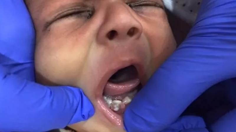 There have been cases of babies being born with one or two teeth but not seven (Photo: YouTube)