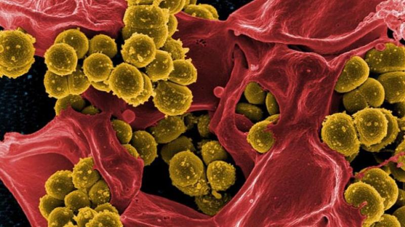 Staphylococcus bacteria also called as  staph,  is found to be a leading cause of healthcare-associated infections, such as pneumonia, bacteraemia, heart valve, and bone and skin infections, according to the Center for Disease Control and Prevention.