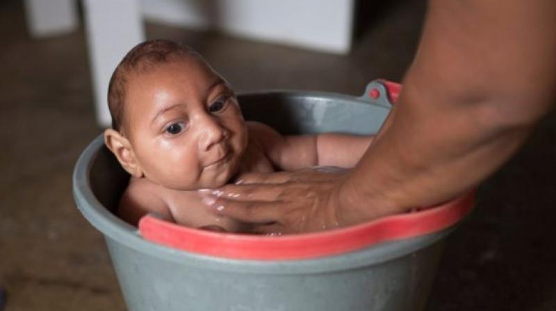 The Zika virus causes devastating birth defects and pregnancy losses even if a woman had only a minor illness. (Photo: AP)