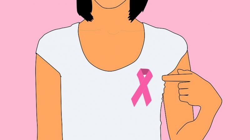 New study has found breast cancer patients are uninformed about surgery options. (Photo: Pixabay)