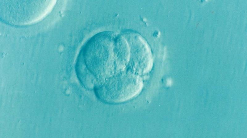 Expert addresses misconceptions of IVF. (Photo: Pixabay)