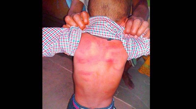 Four-year-old Nikhil was  beaten up for his parents failure in paying fees.