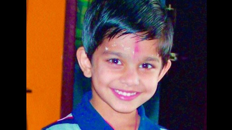 Hardik Jena died due to complications arising after he was administered general anaesthesia for a plastic surgery.