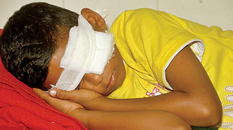 The city witnessed many cases of eye injury again on Monday.