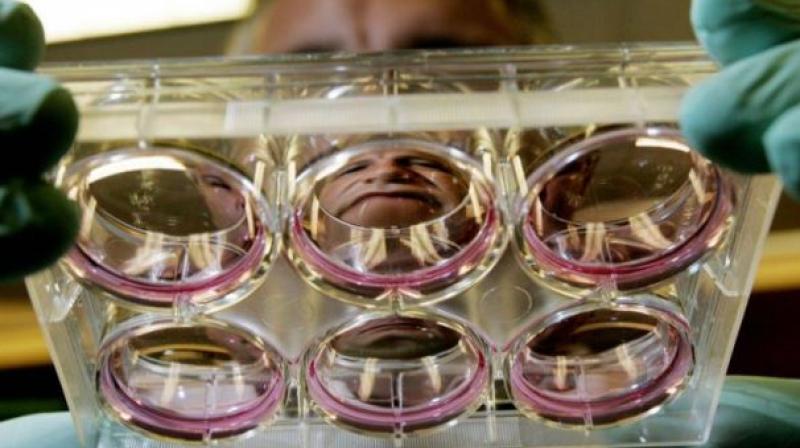 Stimulating the metabolism of stem cells that produce sperms in male body can shed light on new ways to treat infertility (Photo: AFP)