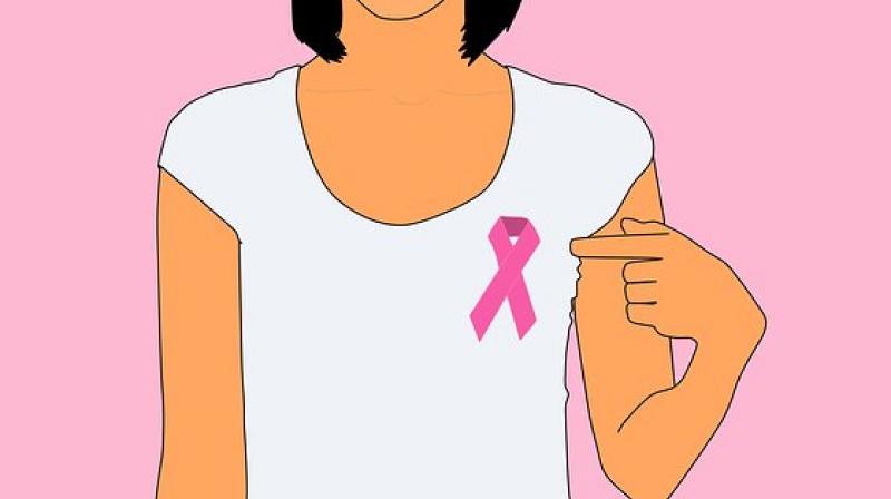 The only treatment options for triple-negative breast cancer are surgery, radiation therapy and chemotherapy. (Photo: Pixabay)