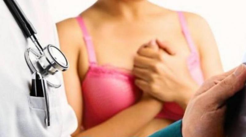 Signs of breast cancer that has become an epidemic in India. (Photo: AFP)