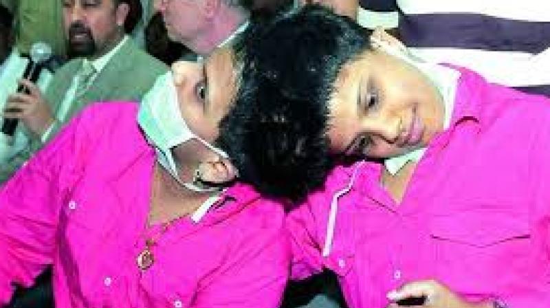 Some hope as conjoined twins Veena-Vani turn 14