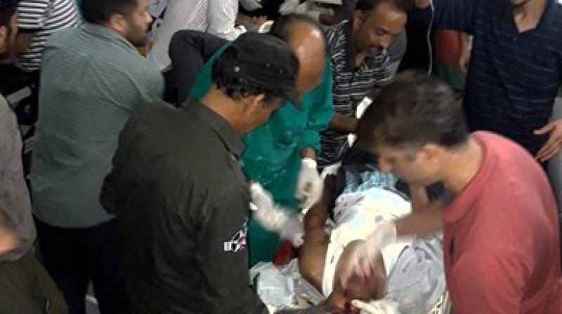 Injured being treated in a hospital after militants opened fire on the Amarnath Yatra in which some pilgrims were killed many injured in Anantnag in Jammu and Kashmir on Monday. (Photo: PTI)