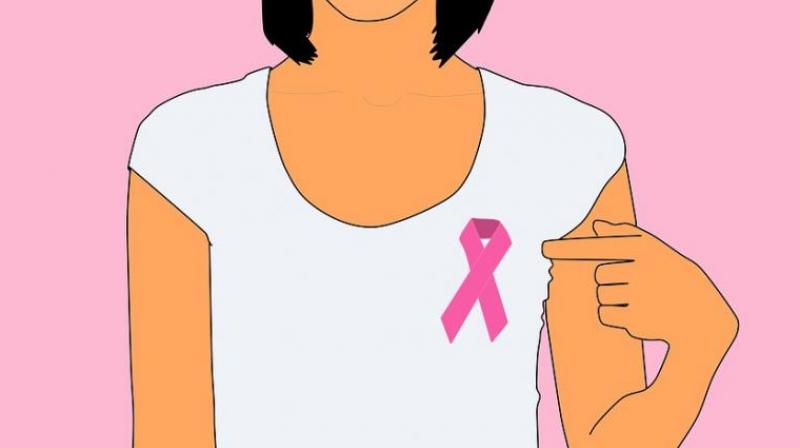 Scientists discover way to treat aggressive forms of breast cancer. (Photo: Pixabay)