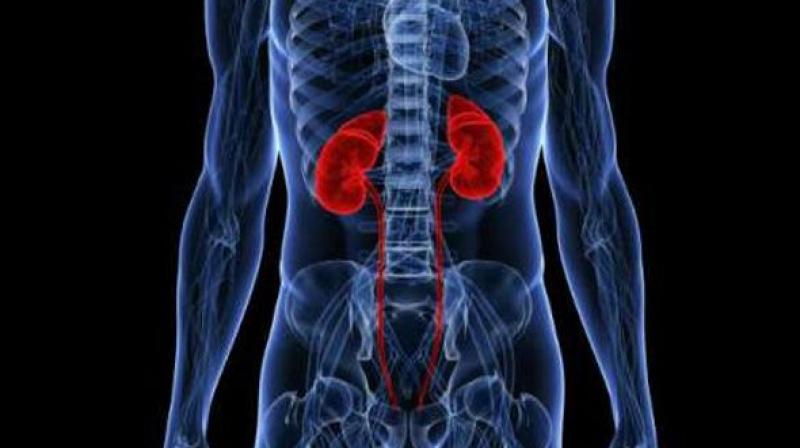 Kidney transplant is a scarce resource, and it is important that scarce medical resources be distributed fairly. (Representational Image)