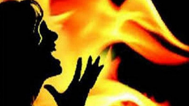 A 30-year-old man allegedly killed a college going girl by setting her on fire. (Representational Image)