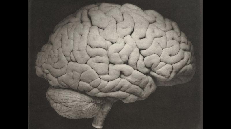This 1885 photo shows a side view of a human brain. In relation to body size, our brains are huge, about six times larger than one would expect from other mammals. And this three-pound organ sucks up fully 20 percent of the bodys energy needs. (Oscar G. Mason/J.C. Dalton/Philadelphia, Lea Brothers & Co. via AP)