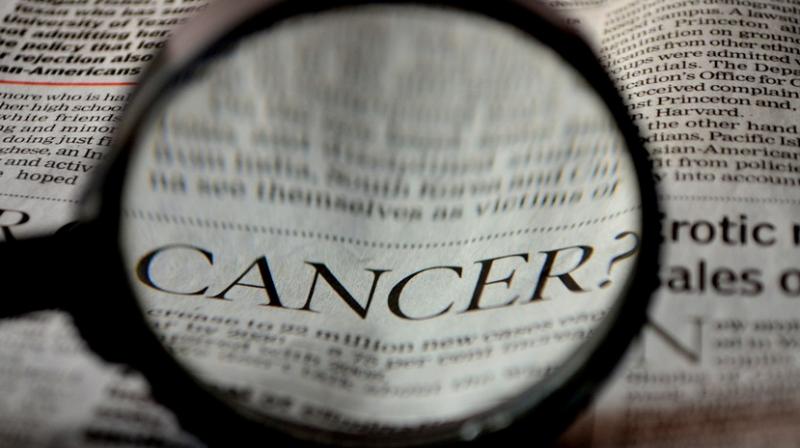 Testicular cancer responds better to chemotherapy than other cancers. (Photo: Pixabay)
