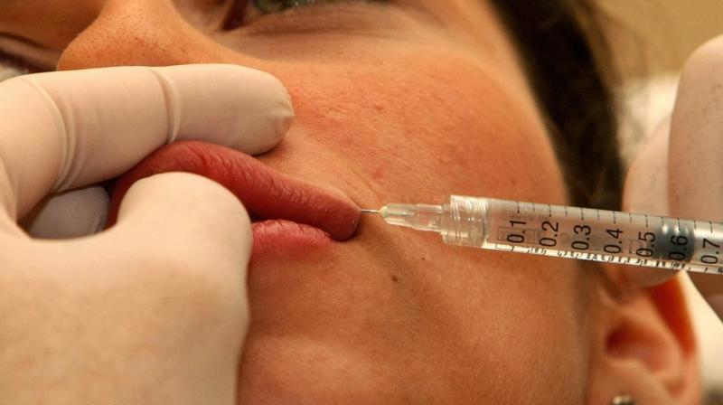 A cosmetic-surgery expert told her that she may lose her lip if the tissue started dying (Photo: AFP)