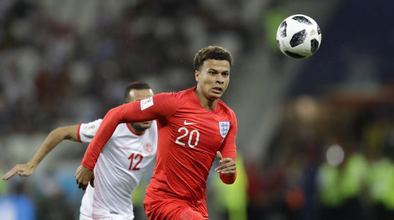 The Tottenham Hotspur player had a scan on Tuesday while his team mates trained after picking up the strain in Volgograd. (Photo: AP)
