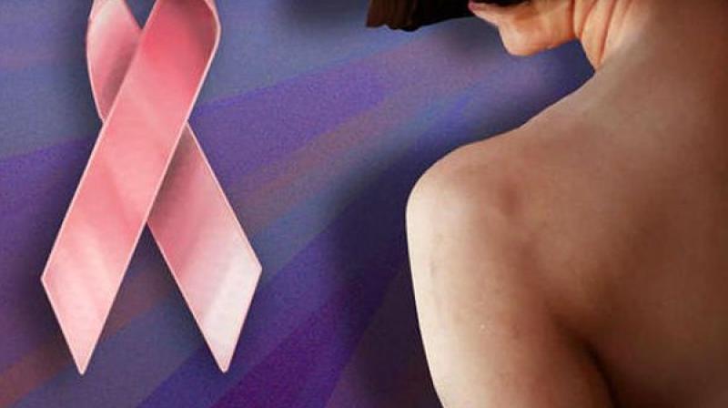 Age may not affect breast reconstruction complications