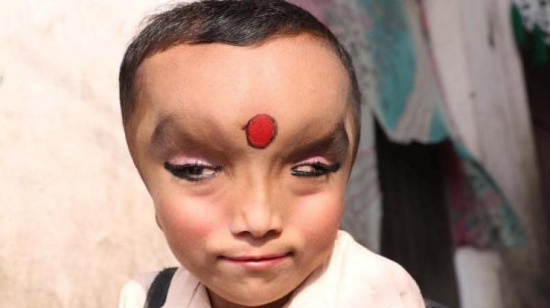 Pranshu has a medical condition that caused him to be born with an enlarged forehead and narrow eyes. (Credit: YouTube)