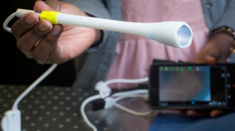A prototype of the speculum-free â€œpocket colposcopeâ€being developed by Duke University produces images on a smart phone or laptop and can make cervical cancer screening more accessible to women living in low-resource areas. (Photo: Facebook / Duke University)