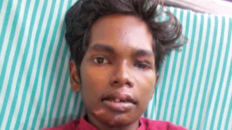 Ajay Ghosh after surgery