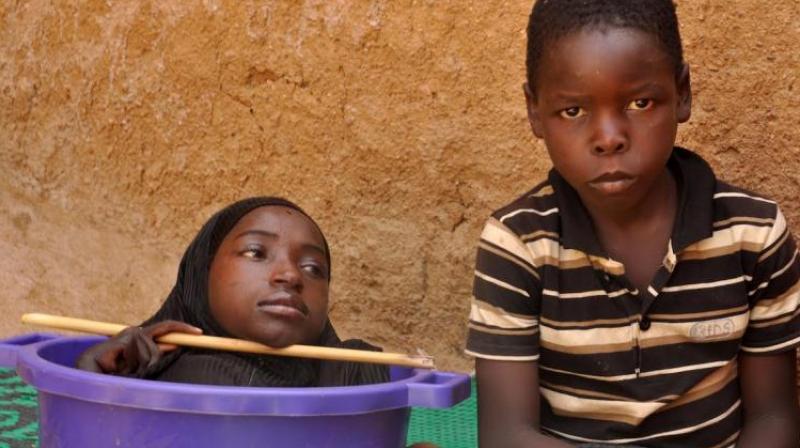 Rahma Haruna, 19, (left) not only has to endure chronic pain but also spends her waking hours in a plastic bowl, which her family carry her around in. (Credit: YouTube)