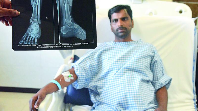 An injured Shiv Shankar Reddy lies on the hospital bed.