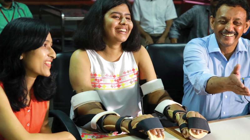 Shreya Siddanagowda, the 19-year-old chemical engineering student of Manipal Institute of Technology, who underwent a rare upper-arm double hand-transplant at AIMS along with her mother Suma Nuggihalli  and Dr Subramania Iyer, head of Department of Plastic and Reconstructive Surgery in Kochi on Wednesday. (Photo: DC)