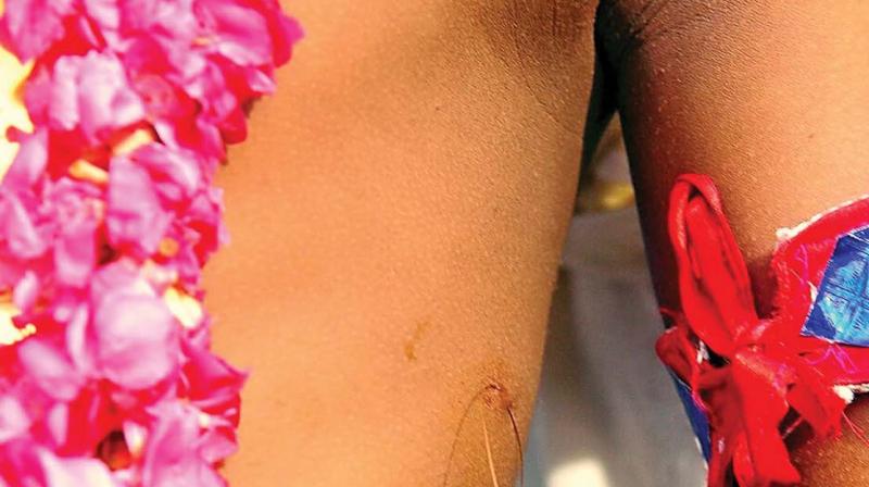 A childs midrib is pierced with golden strings as part of Chooral Muriyal ritual. (Photo DC File)