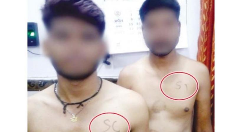 Photographs showing the candidates stamped with â€œSCâ€, â€œSTâ€ and â€œOBCâ€ on their chests during their medical tests in Dhar have gone viral in social media, leaving the Madhya Pradesh government red faced.