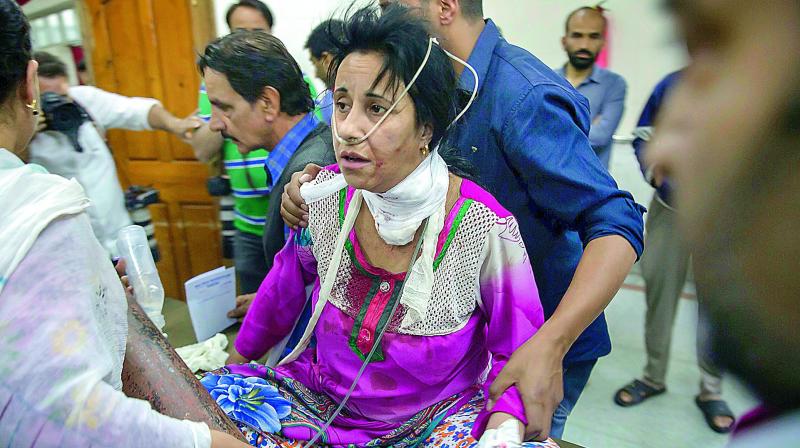 A grenade blast victim at the SMHS hospital, in Srinagar, on Wednesday. (Photo: AP)