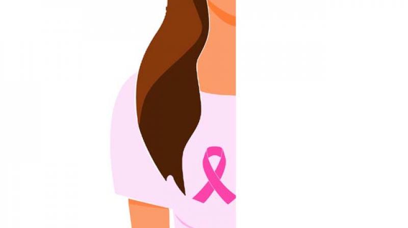 Survival rates after treatment of stage 0 breast cancer is more than 95 per cent.