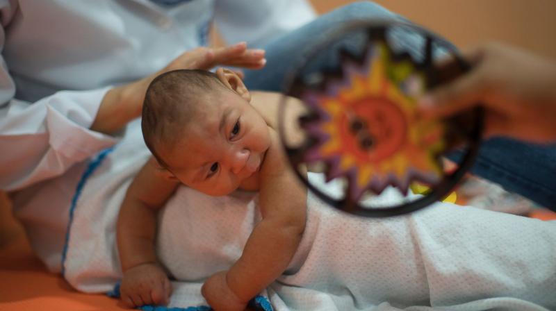 Zika has caused many newborn to be affected by congenital defects like microcephaly. (Photo: AP)